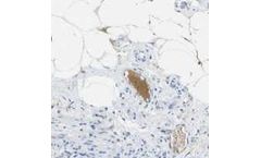 Bioporto - Model ABS 002-09 - Anti-Complement Component C1s Mouse Monoclonal Antibody