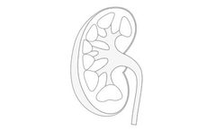 Bioporto - Model KIT 036 - NGAL Elisa Kit (Human)