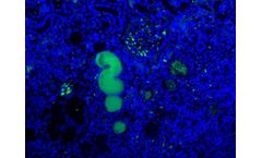 Bioporto - Model ABS 002-49 - Anti-Complement Component C1s Mouse Monoclonal Antibody