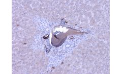 Bioporto - Model ABS 004-22 - Anti-Complement Component C9 (Human) Mouse Monoclonal Antibody