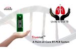 Truenat MTB Real Time micro PCR Test: An Overview - Video