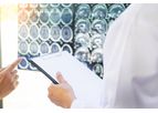 Traumatic Brain Injury (TBI) Treatment