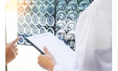 Traumatic Brain Injury (TBI) Treatment