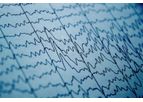 Daily Live EEG Reviews & Reports Service