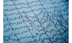 Daily Live EEG Reviews & Reports Service