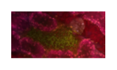 Malaria Vaccine Antigen Discovery - Video