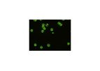 VIRGO - Anti-Neutrophil Cytoplasmic Antibody (C-ANCA) Test System