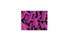 VIRGO - Model C. trach IgG - Human Diagnostics Infectious