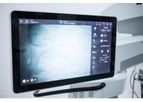 TIVATO - Model 700 - Surgical Microscopes