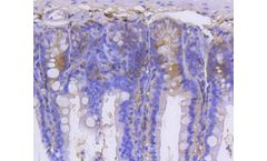 Huabio - Model GARS -SC0651 ET1610-67 - Recombinant Rabbit Monoclonal Antibody