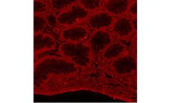 Huabio - Model LMNB2 -R1408-4 - Rabbit Polyclonal Antibody