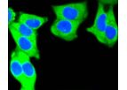 Huabio - Model MSH2- ER1803-86 - Rabbit Polyclonal Antibody