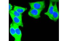 Huabio - Model MSH2- ER1803-86 - Rabbit Polyclonal Antibody