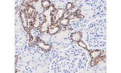 Huabio - Model CLDN7  -6-G3 M1412-2 - Mouse Monoclonal Antibody