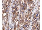 Huabio - Model Claudin18 -HA500131 - Rabbit Polyclonal Antibody