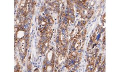 Huabio - Model Claudin18 -HA500131 - Rabbit Polyclonal Antibody