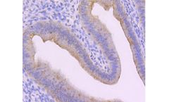 Huabio - Model 13 -R1601-8 - Cytokeratin Rabbit Polyclonal Antibody
