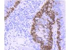 Huabio - Model 17 - ER1901-01 - Cytokeratin Rabbit Polyclonal Antibody