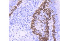 Huabio - Model 17 - ER1901-01 - Cytokeratin Rabbit Polyclonal Antibody