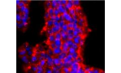 Huabio - Model PRMT1 -JA11-17-ET1704-19 - Recombinant Rabbit Monoclonal Antibody