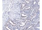 Huabio - Model ST05-25 -ET1609-67 - HIF-1 Beta Recombinant Rabbit Monoclonal Antibody