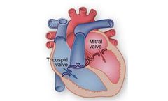 Novostia - Heart Valves