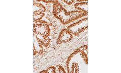 GeneAb - Model IHC500-7 - 5-methylcytosine Antibody