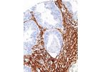 GeneAb - Model IHC506 - Actin, Smooth Muscle Antibody