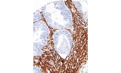 GeneAb - Model IHC506 - Actin, Smooth Muscle Antibody