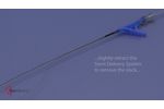 Stent Deployment - Video