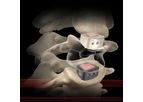 Alamo - Model C - Anterior Cervical Intervertebral Device