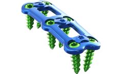 FuseACP - Anterior Cervical Plating System