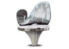 Sterizo - Total Knee System