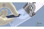 Rayner RaySert PLUS mini incision Injector loading instructions - Video