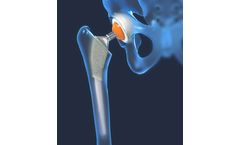 Tecomet - Femoral Heads