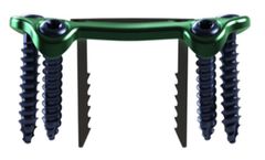 Model DynaForce - Staple Compression Plates