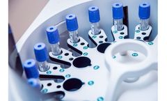 Calder - Protein Engineering Technology