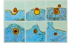 Calder - Universal Flu Vaccine Program