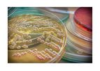 AcinetoVax - Model VXD001 - Inactivated LPS-null (endotoxin free) Whole-Cell Acinetobacter Baumannii Vaccine