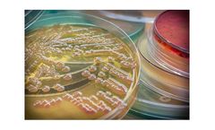 AcinetoVax - Model VXD001 - Inactivated LPS-null (endotoxin free) Whole-Cell Acinetobacter Baumannii Vaccine