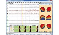 BESA - Version Research 7.1 - State-of-the-art Research Tools