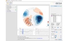 BESA - Version Statistics 2.1 - Software For ANOVA/ANCOVA Analysis