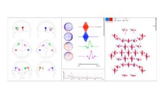 BESA - Version Simulator - Tool for Simulating Evoked and Induced Brain Activity