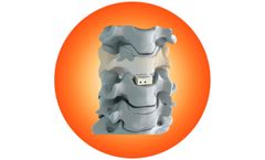 Biotechni - Model Anatomix-C - Anterior Cervical Cage