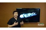 Bone Foam Anterior Cervical Patient Positioning - Nextend - Video