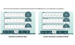 PneuView - Lung Simulator Software