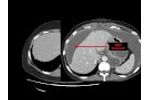 Introduction to CT Abdomen and Pelvis: Anatomy and Approach - Video