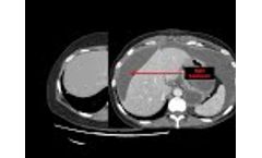 Introduction to CT Abdomen and Pelvis: Anatomy and Approach - Video