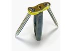 Idys - Model LLIF 3DTi - Lateral Lumbar Interbody System