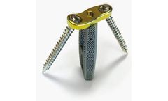Idys - Model LLIF 3DTi - Lateral Lumbar Interbody System